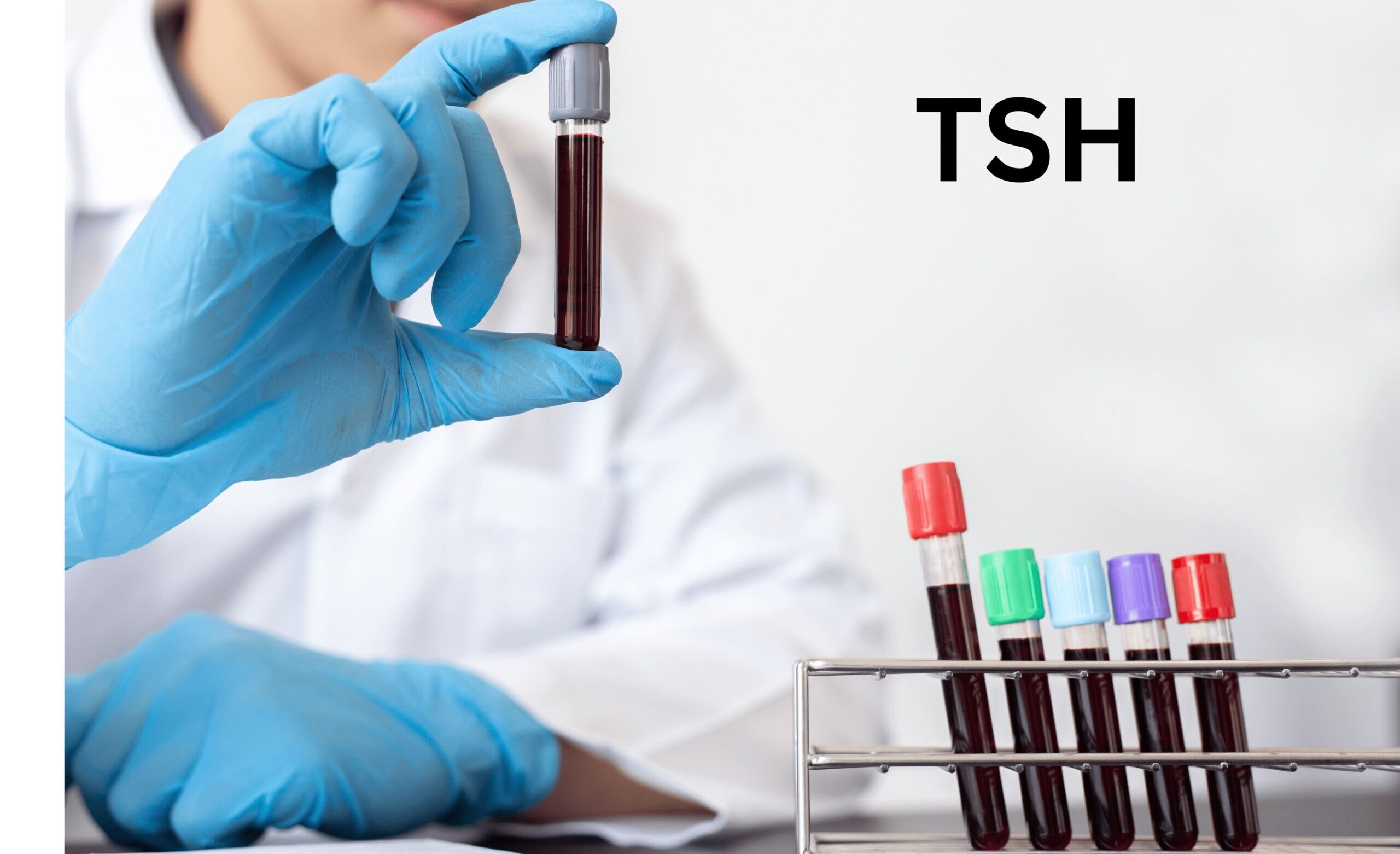 TSH Alto ou Baixo: Alterações e Importância Clínica
