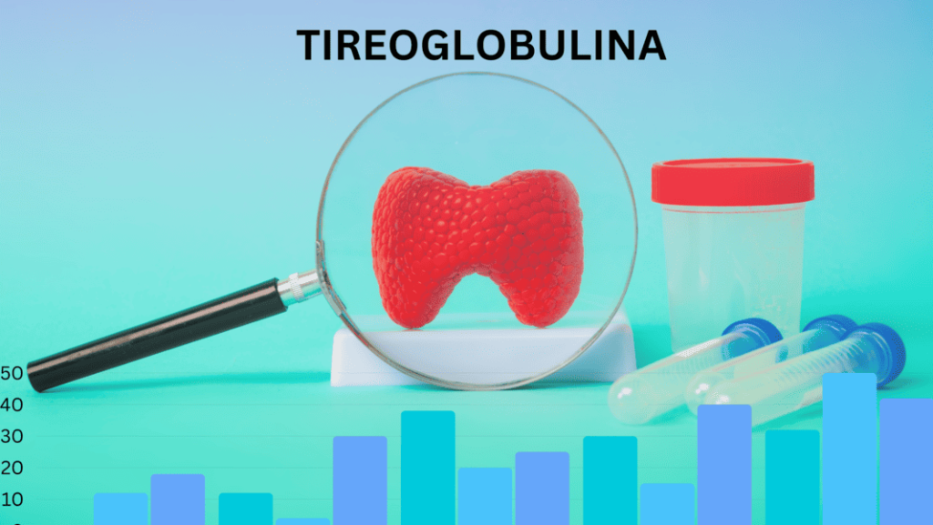 EXAME TIREOGLOBULINA -SAUDE-DIAGNOSTICA