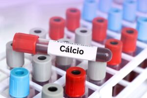 saude-diagnostica-calcio-niveis-alto-baixo-tratamento-diagnostico