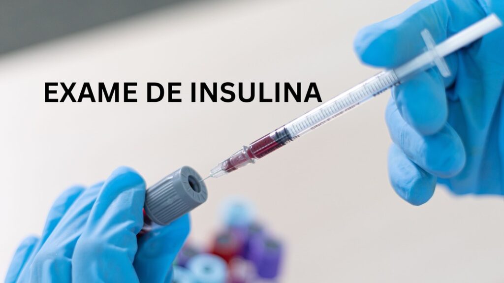 insulina-exame-saude-diagnostica