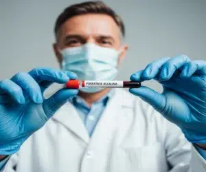 fosfatase-alcalina-alta-entenda-o-exame-saúde-diagnóstica