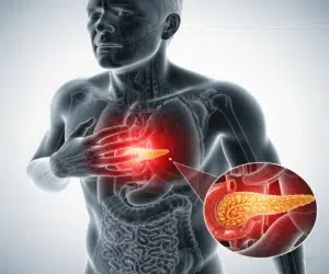 lipase-alta-o-que-significa-entenda-o-exame-saúde-diagnóstica