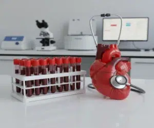 troponina-cardiaca-interpretacao-e-significado-clinico-saude-diagnostica