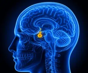 Ilustração médica em raio-X da cabeça humana em azul com a hipófise destacada em amarelo, relacionada à produção de prolactina e macroprolactina