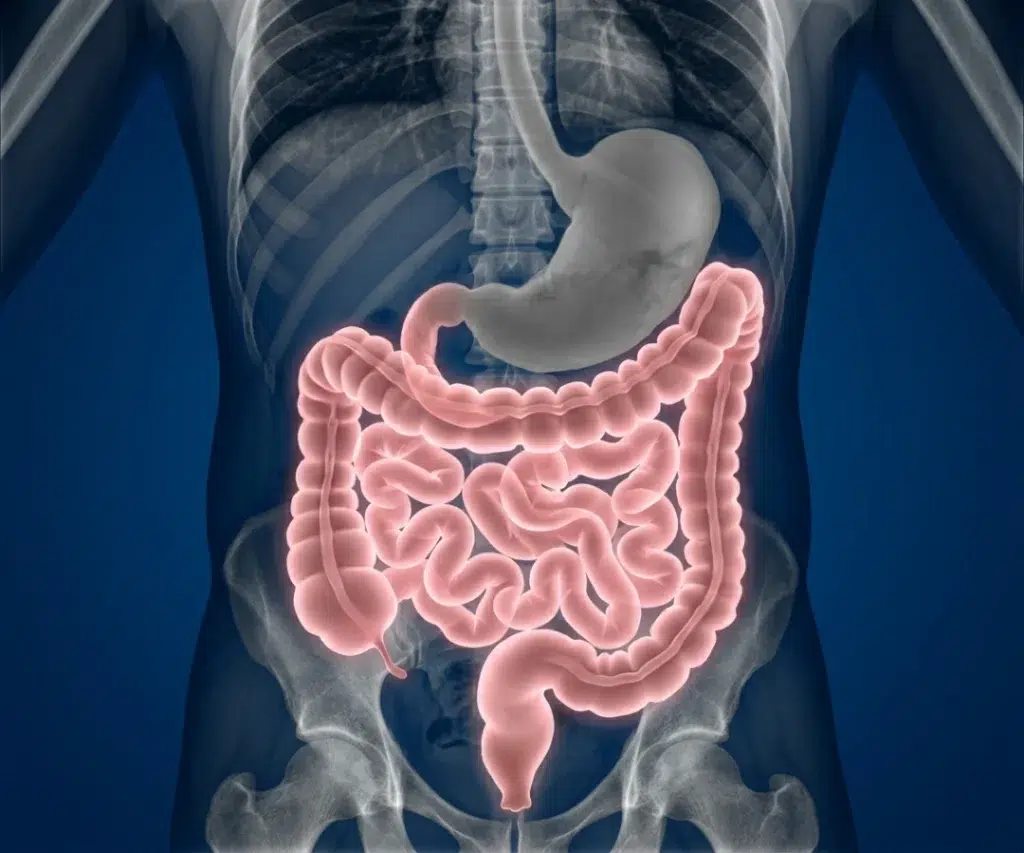 Imagem médica estilizada do torso humano em fundo azul escuro. Estruturas ósseas como costelas, coluna vertebral e pelve são visíveis em formato de raio-X cinza. Sobreposta à estrutura esquelética, há uma representação tridimensional do trato gastrointestinal inferior: o estômago é exibido no centro superior em cinza claro, conectado ao intestino delgado e ao intestino grosso (cólon), que estão destacados em um tom rosa brilhante e semitransparente, evidenciando suas curvas e anatomia.