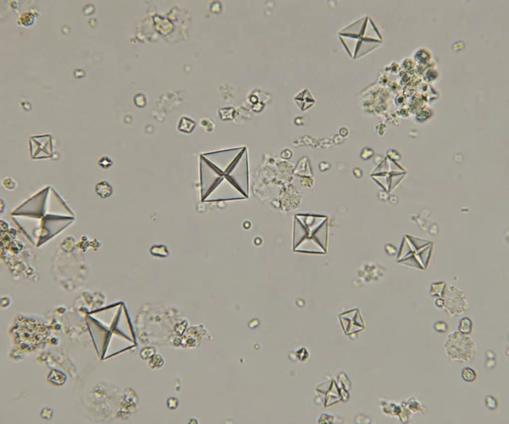Imagem microscópica de cristais de oxalato de cálcio, com múltiplos cristais transparentes em formato de envelope (octaedros) distribuídos sobre um fundo claro, característicos de sedimento urinário observado em microscopia óptica.