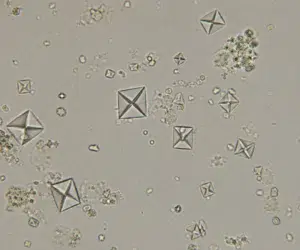 Imagem microscópica de cristais de oxalato de cálcio, com múltiplos cristais transparentes em formato de envelope (octaedros) distribuídos sobre um fundo claro, característicos de sedimento urinário observado em microscopia óptica.
